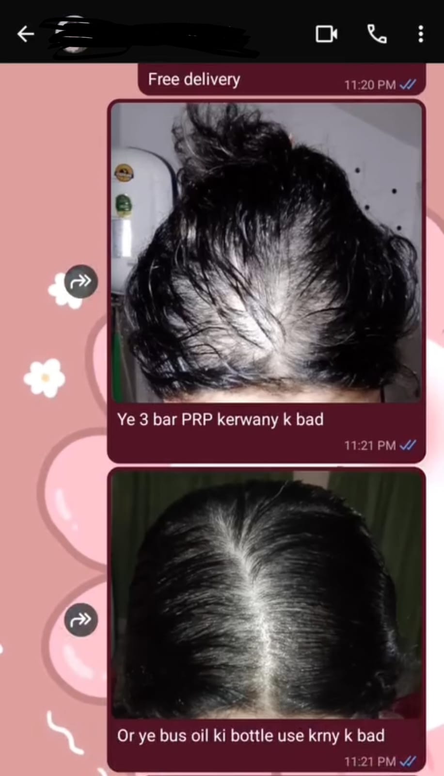 Rosemary Hair & Scalp Oil With Batana Oil