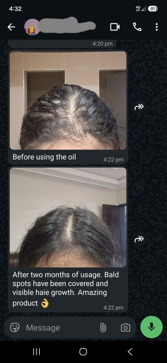Rosemary Hair & Scalp Oil With Batana Oil